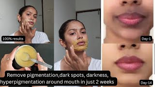 2 home remedies to remove dark spotsdark black patches pigmentation around mouth  100 results [upl. by Rehteh]