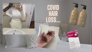 10 tips for Telogen Effluvium \\ Covid Hair Loss \\ My Experience amp What Helped [upl. by Trevar]