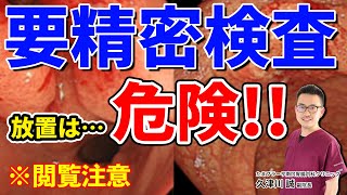 放置しておくと危険 要精密検査って症状が何もなければ大丈夫？ 教えて久津川先生 No137 [upl. by Huff]