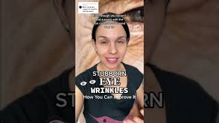 Stubborn eye wrinkles can be frustrating eyewrinkles antiagingskincare skincare eyes wrinkles [upl. by Paulina]