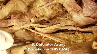 RIGHT INTERNAL ILIAC ARTERY Divisions Branches and Variation  Sanjoy Sanyal [upl. by Alphonsine]