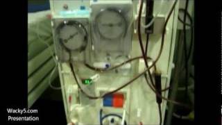 Dialysis Machine Parts And Indications Of Dialysis [upl. by Lahsram]