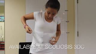 CheneauGensingen Scoliosis Brace  Easy to Put On [upl. by Kathy]