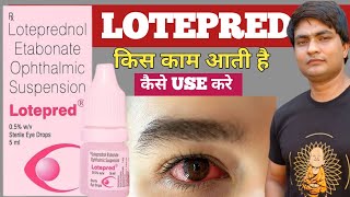 lotepred eye drop  lotepred eye drops  lotepred eye drops uses in hindi  lotepred eye drops uses [upl. by Mchail]