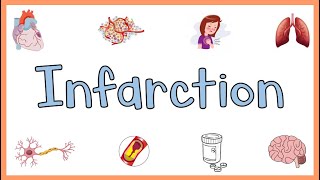 Infarction  Causes Types Morphology amp Factors influencing development of infarction [upl. by Wagshul]