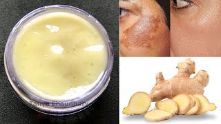 DIY Ginger Cream  Remove Pigmentation Dark Spots amp Acne Scars AntiAging amp Skin Lightening Cream [upl. by Brader]