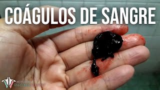 Lo que NECESITAS saber sobre los COÁGULOS DE SANGRE [upl. by Retsof591]