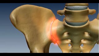 Where is the Sacroiliac Joint Anatomy of the Sacroiliac Joint [upl. by Haidebez477]