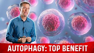 The Most Important Benefit of Autophagy Will Surprise You [upl. by Nodmac]