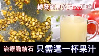 治療膽結石的驗方：只需這一杯果汁，轉發給更多的人知道！ [upl. by Liva]