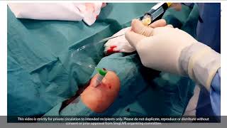 Transradial PCI and Rotablation  Singapore LIVE 2020 [upl. by Turnbull496]