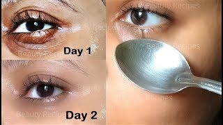 How to Remove Under Eye WRINKLES Under Eye Bags Puffy eyes amp Dark Circles in 1 Day with ice cubes [upl. by Nylaf]