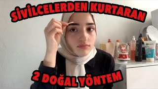 SİVİLCELERDEN 1 GECEDE KURTARAN 2 DOĞAL ÇÖZÜM EVDE [upl. by Nimoynib]