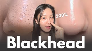 How to really remove blackheads at home in 7 days No matter your skin type [upl. by Atikim182]