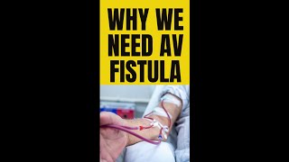 Why we need AV Fistula [upl. by Anirtac]