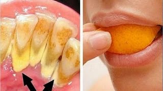 Eliminar el sarro y blanquear tus dientes en 15 minutos con esta receta [upl. by Ev533]