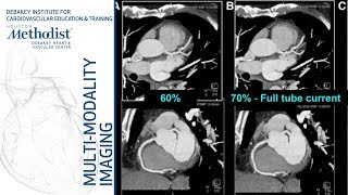 Cardiac CT Current Technology amp Principles Faisal Nabi MD FACC September 11 2018 [upl. by Molloy985]