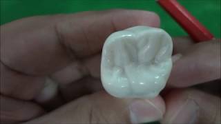 Maxillary Permanent First Molar Morphology [upl. by Affer23]