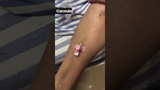 Properly cannula insertion shortvideo cannulation intravenous injection nursing trending [upl. by Soma]