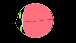 Common disorders of the eye and NCLEX style practice questions [upl. by Annohsal]