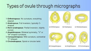 types of ovule  Bsc [upl. by Kory]