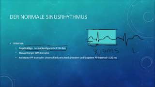 EKG befunden leicht gemacht Teil 2 [upl. by Krigsman]