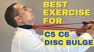 Best Exercises For C5 C6 Bulging Disc  C5 C6 Herniated Disc Exercises by Dr Walter Salubro [upl. by Nagap998]