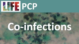 Pneumocystis coinfections [upl. by Ardnasella]