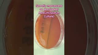 Serratia marcescens growth on Macconkey agar [upl. by Nnylsaj]