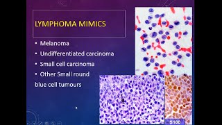 Lymph Node FNA Cytology Approach [upl. by Hgierb128]