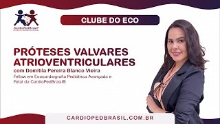 Próteses Valvares Atrioventriculares [upl. by Nevarc]