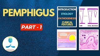 Pemphigus Part 1  Etiology Pathogenesis Pemphigus Vulgaris  Clinical features  Nikolskys Sign [upl. by Yrtnej467]