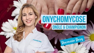 Les onychomycoses des champignons dans les ongles comment les soigner  DermatoDrey [upl. by Us894]