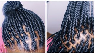 HOW TO DO YARN BRAIDS THE BEST BOX BRAIDING TECHNIQUE [upl. by Perle394]