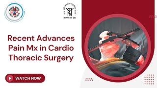 Recent Advances Pain Mx in Cardio Thoracic Surgery [upl. by Asilef]