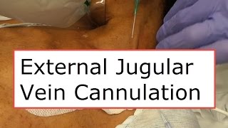 External Jugular Vein Cannulation [upl. by Ettenaj]