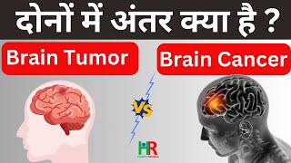 brain tumor and brain cancer in hindi  ब्रेन ट्यूमर और ब्रेन कैंसर की पूरी जानकारी हिंदी में [upl. by Dlorej]