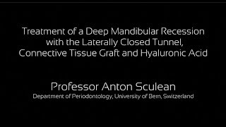 Prof Anton Sculeans treatment of a deep mandibular recession with crosslinked hyaluronic acid gel [upl. by Gnemgnok379]