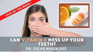 CAN VITAMIN C MESS UP YOUR TEETH [upl. by Tidwell]