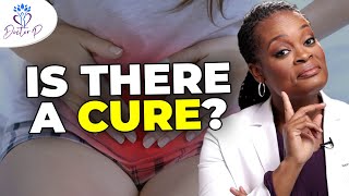 How To Get Rid Of A Yeast Infection At Home [upl. by Hahsi]