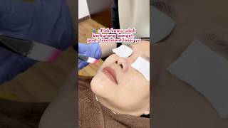 Peeling doang kok 🤭 saffaclinic klinikkecantikan melanopeel peelingwajah treatmentflek [upl. by Ekralc]