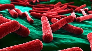 Everything to know about E coli amid outbreak [upl. by Aivatal]