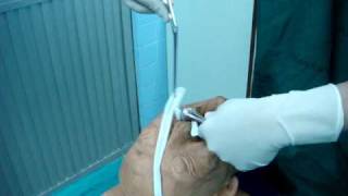 Anterior nasal packing ENT PMK [upl. by Hcahsem]