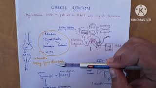 Cheese Reaction Unveiled Tyramine and MAO Inhibitors Explained [upl. by Pessa]