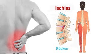 5 einfache Übung um den Ischiasnerv zu entlasten [upl. by Merfe788]