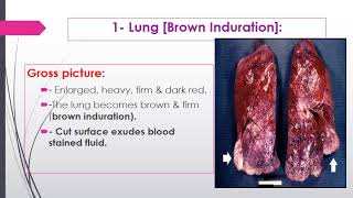 Hemodynamic disorders2 2024 [upl. by Elledoj]