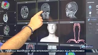 Pozzilli nuovi test per interventi chirurgici alla Neuromed [upl. by Ihsakat]