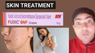 fudic bnf cream use in hindi [upl. by Einnaffit]