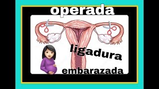 SALPINGO OPERADA Y EMBARAZADALIGADURA DE TROMPAS Y EMBARAZADA LA FAMILIA [upl. by Etnoid]