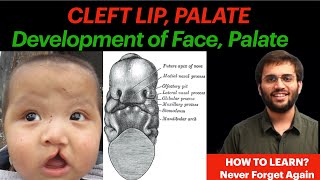 Development of Palate Face  Embryology  Cleft Lip Cleft Palate Video Human Embryology [upl. by Aihsetel]